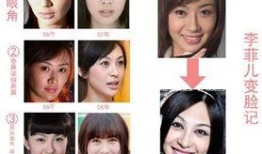 西安整容爆料事件视频最新,揭秘行业乱象，患者权益引关注